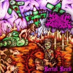 Syphilic Diarrhea : Rectal Reich